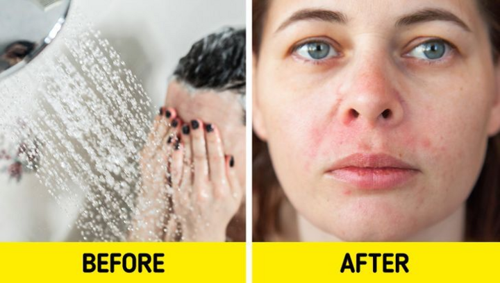 Vì sao không nên rửa mặt khi tắm dưới vòi hoa sen? - 5