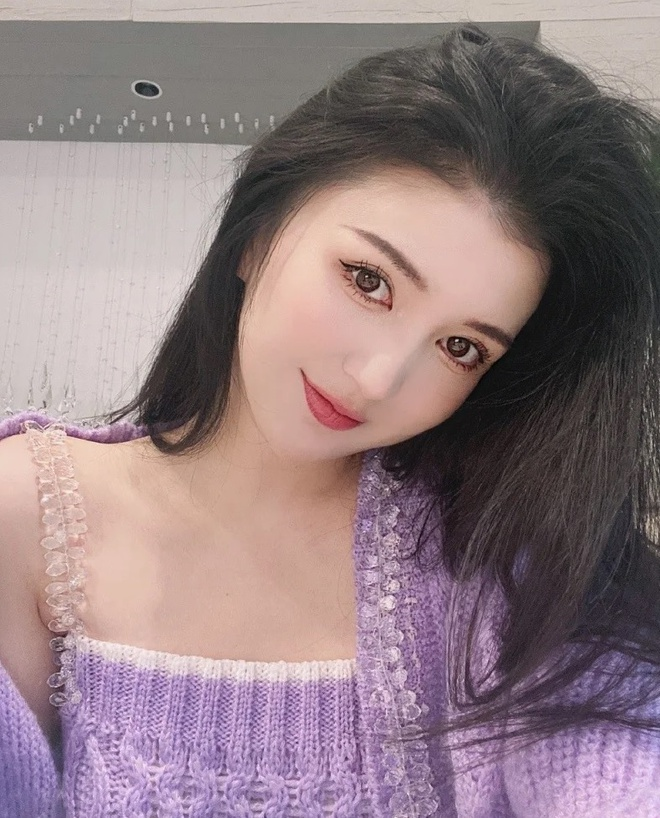 Ca sĩ Trung Quốc chết sau khi nâng ngực, hút mỡ - 1