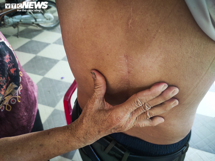 Anh hùng phá bom nổ chậm kể chuyện 'bị thần chết bỏ quên' - 4