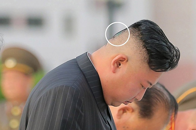 Miếng băng dán y tế trên đầu ông Kim Jong-un gây chú ý - 2