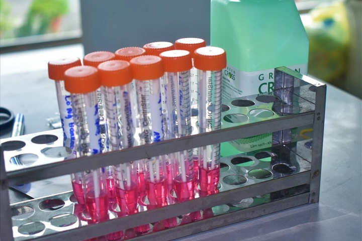 Cần biết: 16 loại test nhanh SARS-CoV-2 được Bộ Y tế cấp phép - 1