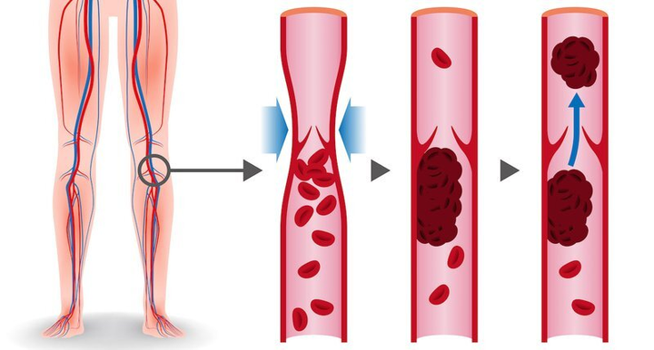 Điều gì xảy ra với cơ thể nếu bạn ngừng ăn trái cây và rau xanh? - 6