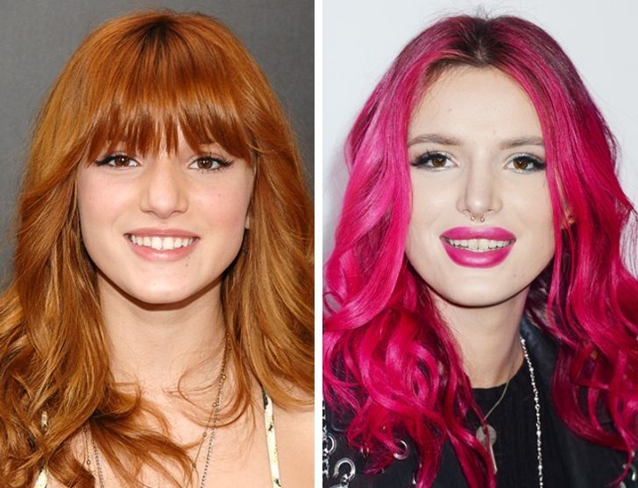 Ảnh: Gương mặt người nổi tiếng thay đổi thế nào sau phẫu thuật thẩm mỹ? - 10