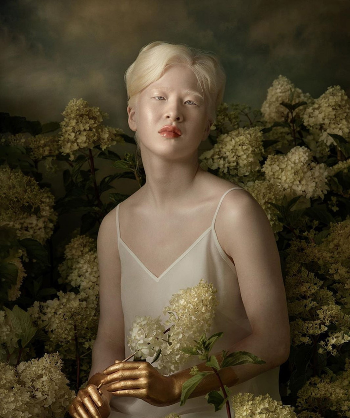 Vẻ đẹp kỳ lạ của người mẫu bạch tạng vốn là bé gái bị cha mẹ vứt bỏ - 10