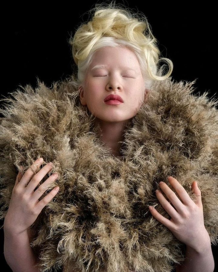 Vẻ đẹp kỳ lạ của người mẫu bạch tạng vốn là bé gái bị cha mẹ vứt bỏ - 2