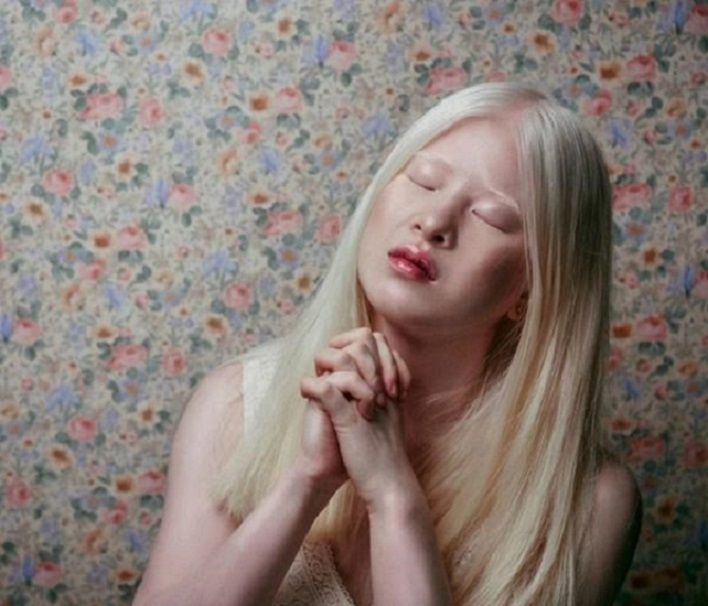 Vẻ đẹp kỳ lạ của người mẫu bạch tạng vốn là bé gái bị cha mẹ vứt bỏ - 11