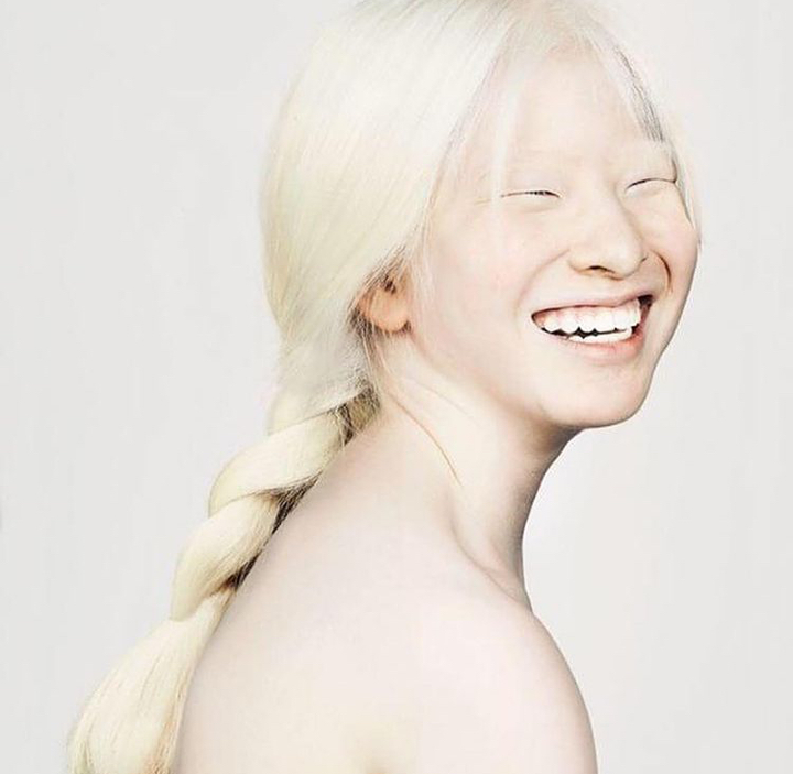 Vẻ đẹp kỳ lạ của người mẫu bạch tạng vốn là bé gái bị cha mẹ vứt bỏ - 5