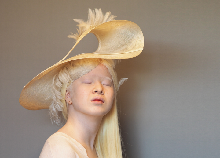 Vẻ đẹp kỳ lạ của người mẫu bạch tạng vốn là bé gái bị cha mẹ vứt bỏ - 6