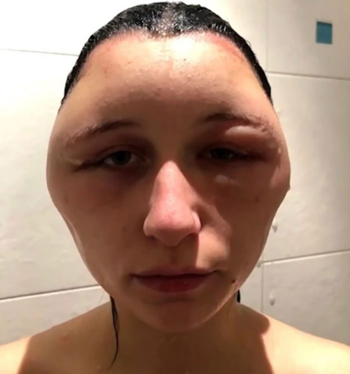 Cười ra nước mắt với loạt tai nạn khó đỡ khi tự nhuộm tóc tại nhà - 9