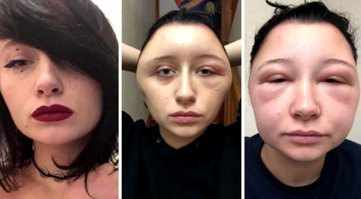 Cười ra nước mắt với loạt tai nạn khó đỡ khi tự nhuộm tóc tại nhà - 8