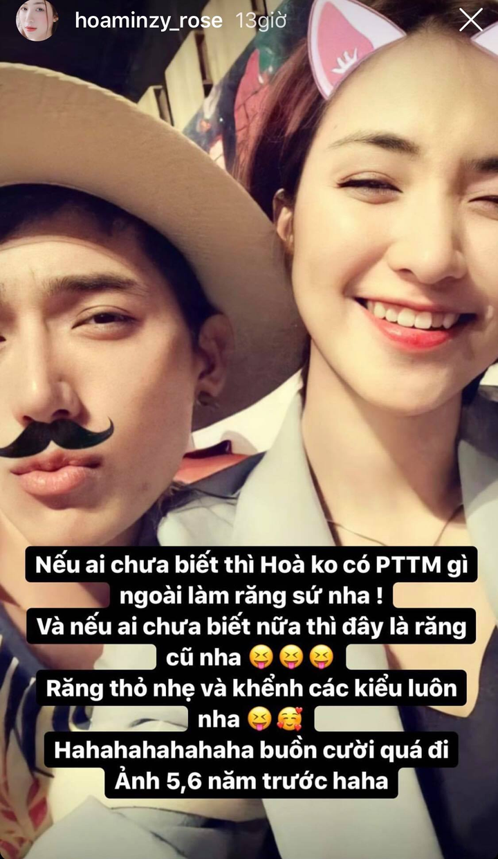 Không giảm cân hay dao kéo, Hòa Minzy lột xác nhờ thay đổi 1 điểm trên khuôn mặt - 1