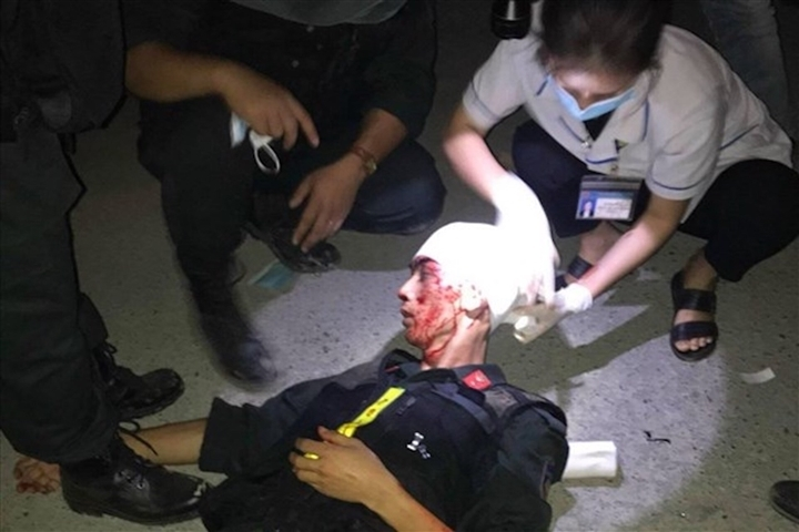 Bảo vệ thiết bị điện gió, nhiều công an Quảng Trị bị đánh: Khởi tố vụ án - 1