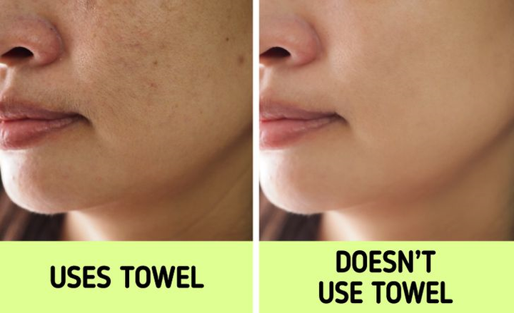Tác hại ghê gớm của thói quen dùng khăn lau khô sau khi rửa mặt - 1