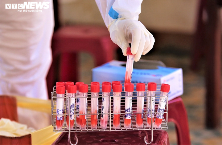 Thêm 9 bệnh nhân ở Bệnh viện Tâm thần Quảng Nam mắc COVID-19 chưa rõ nguồn lây - 1