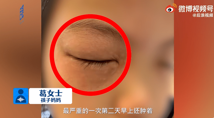 Bé gái mắc chứng bệnh kỳ quái, cứ làm bài tập toán là bị dị ứng - 1