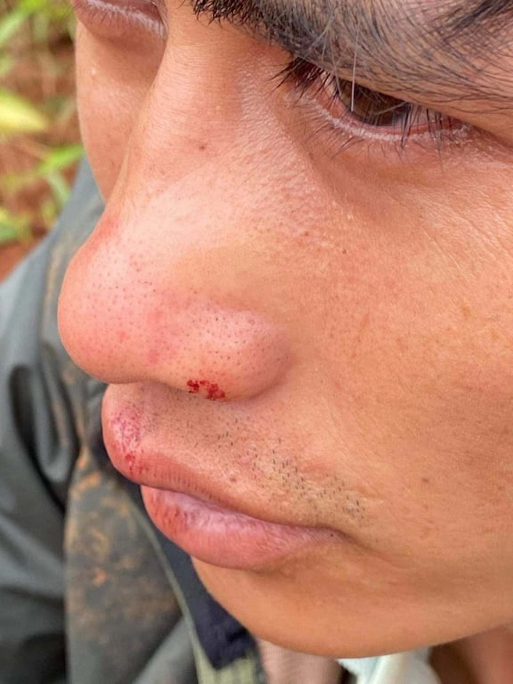 Xác định nhóm côn đồ được công ty làm điện gió thuê đánh dân - 3