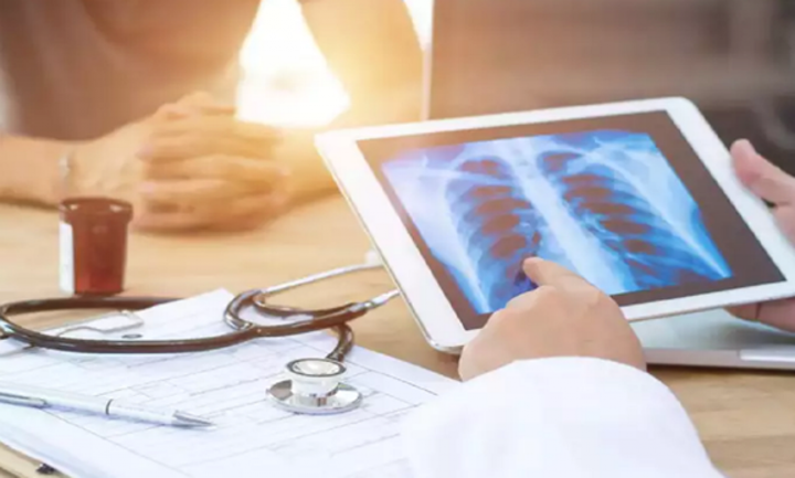 4 nhóm đối tượng có nguy cơ mắc COVID-19 kéo dài cao nhất - 5