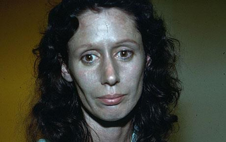 Gia tộc người da màu xanh và hành trình 'hóa giải lời nguyền' hàng trăm năm - 6