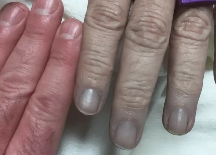 Gia tộc người da màu xanh và hành trình 'hóa giải lời nguyền' hàng trăm năm - 5