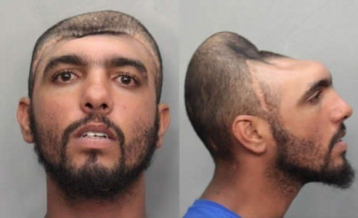 Chàng trai ‘không não’ nhưng vẫn sống khỏe suốt 20 năm một cách kỳ lạ - 5