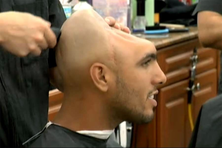 Chàng trai ‘không não’ nhưng vẫn sống khỏe suốt 20 năm một cách kỳ lạ - 2