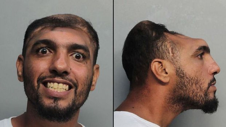 Chàng trai ‘không não’ nhưng vẫn sống khỏe suốt 20 năm một cách kỳ lạ - 3