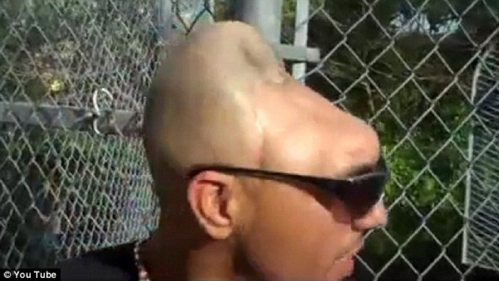 Chàng trai ‘không não’ nhưng vẫn sống khỏe suốt 20 năm một cách kỳ lạ - 4