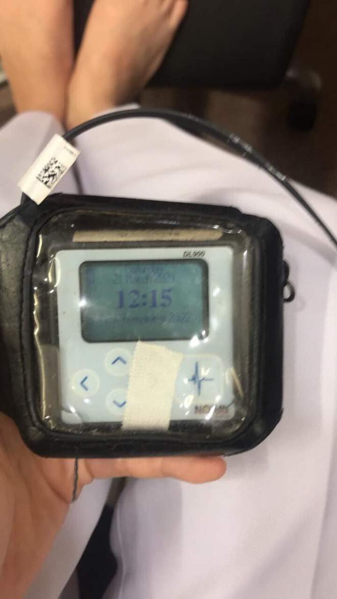 Cô gái bị rối loạn nhịp tim nặng, phải đeo máy theo dõi tim vì... có người yêu - 1