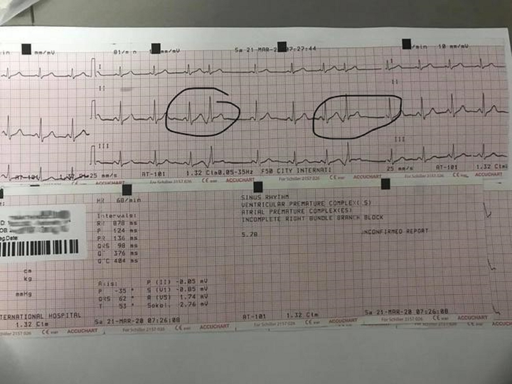 Cô gái bị rối loạn nhịp tim nặng, phải đeo máy theo dõi tim vì... có người yêu - 2