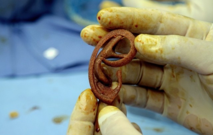 Kỳ lạ người đàn ông ‘mọc’ thêm tai ở cánh tay, nguyên do còn gây kinh ngạc hơn - 3