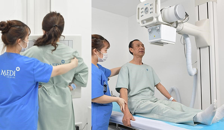 MEDIPLUS: Địa chỉ lý tưởng cho trải nghiệm dịch vụ chẩn đoán hình ảnh - 2