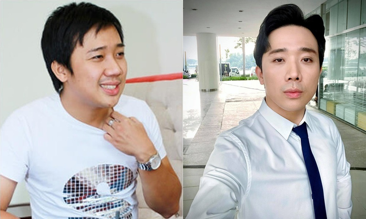 Trấn Thành lột xác sau 15 năm, thừa nhận 'đẹp nhân tạo còn hơn xấu tự nhiên' - 2