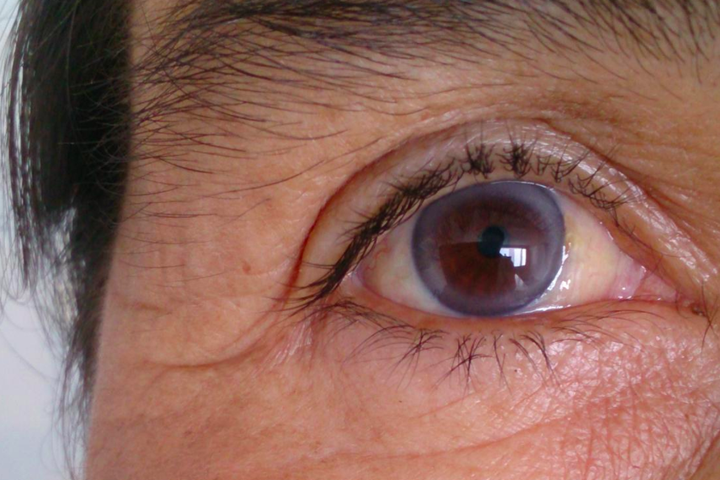 11 tín hiệu ngầm cảnh báo hàng loạt bệnh: Nếu không can thiệp sẽ tiến triển nặng - 3