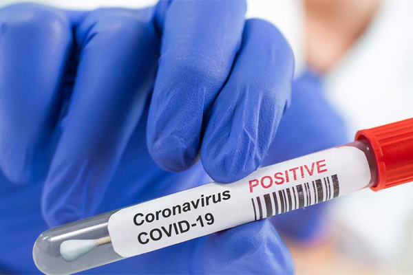 Các biến thể SARS-CoV-2 mới sẽ tiếp tục xuất hiện và nguy hiểm hơn? - 1