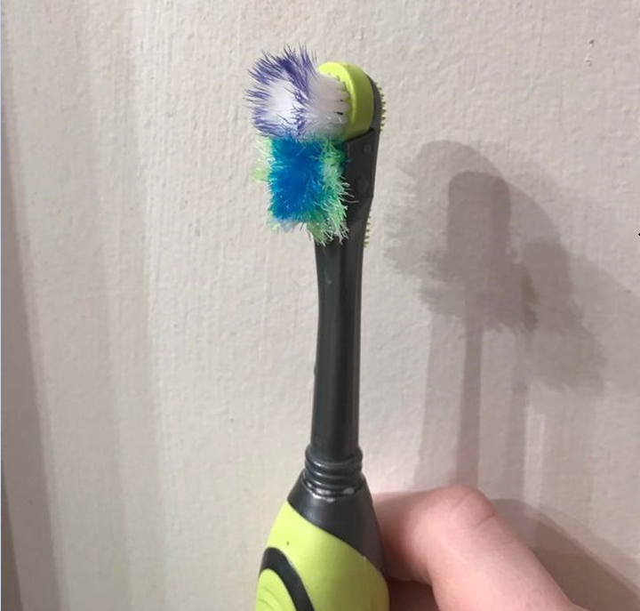 4 dấu hiệu cảnh báo bạn đang đánh răng quá kỹ và cách khắc phục để giữ răng khỏe - 3