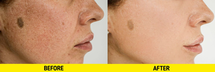 6 lợi ích bất ngờ từ nước gạo: Công thức bí mật giúp người Nhật trẻ đẹp tự nhiên - 4