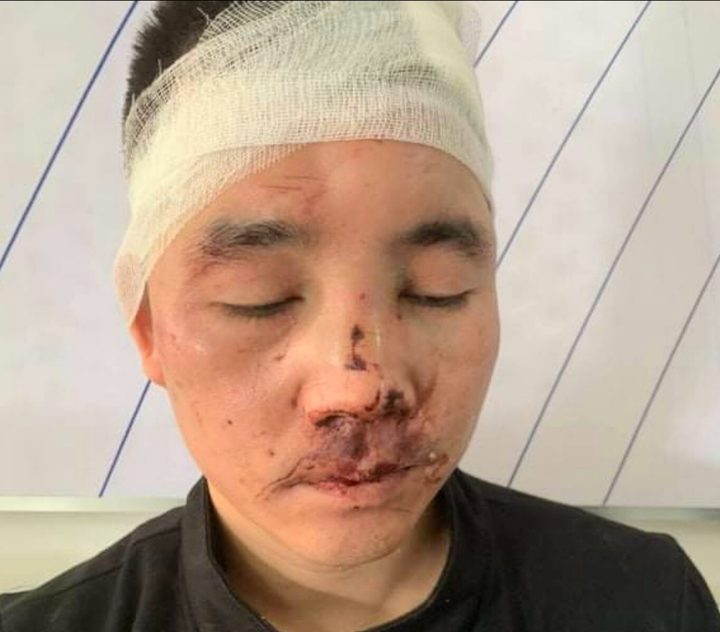 Tuyên Quang: Nhóm người chặn xe khách, hành hung 2 phụ xe đến nhập viện - 1