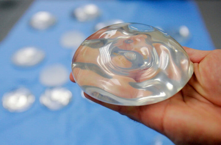 FDA đưa ra cảnh báo về nguy cơ tiềm ẩn khi nâng ngực: Phụ nữ nên cân nhắc trước - 1