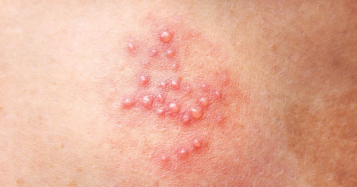 Lý do bạn được khuyên tiêm đủ 9 loại vaccine, không nên bỏ qua dù chỉ 1 loại - 3