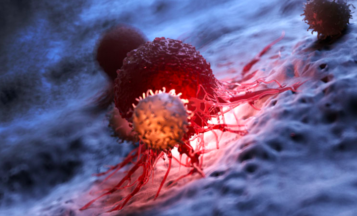 6 biểu hiện bất thường trong cơ thể này chính là 'điềm xấu' cảnh báo ung thư - 1