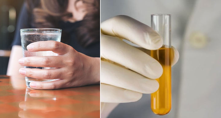 Bệnh ung thư có tỷ lệ sống cực thấp: Phát hiện 2 dấu hiệu cảnh báo trước 3 tháng - 2