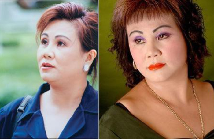 Nghệ sĩ Hoàng Lan bệnh nặng nhưng xin ra viện bởi không còn tiền - 2