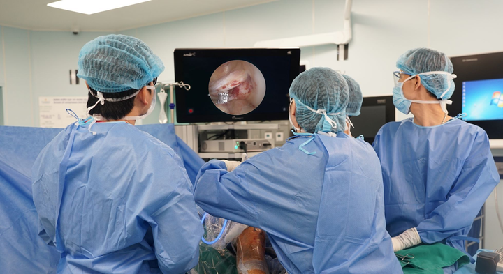 Tái tạo dây chằng chéo trước khớp gối với phương pháp 'ánh xạ giải phẫu' - 4