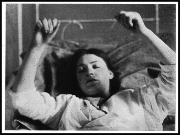 Dịch bệnh buồn ngủ biến người thành ‘tượng sống’ từng gieo kinh hoàng khắp nơi - 3