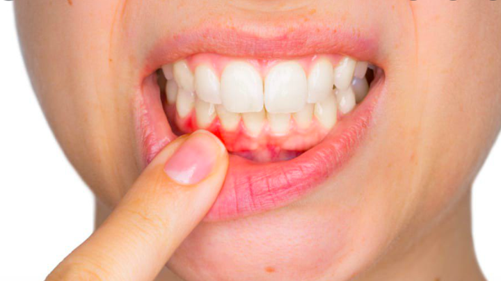 4 dấu hiệu xuất hiện vào buổi sáng cảnh báo gan của bạn đang 'kêu cứu' - 3