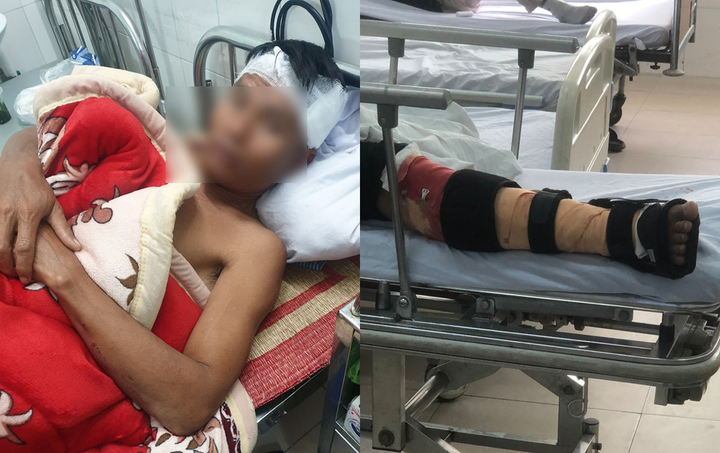 Truy tìm nhóm côn đồ đâm chém dã man 3 ngư dân trên biển Hải Phòng - 1