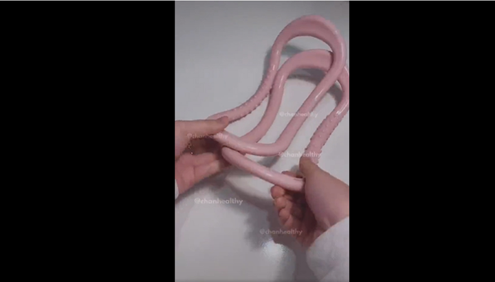 Kẹp làm thon bắp chân đang náo động Tiktok, chuyên gia khuyên mua hay đừng? - 1