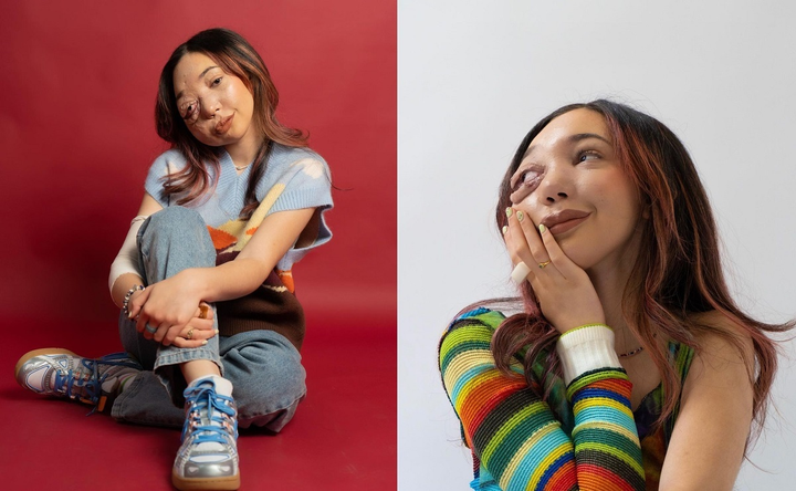 Bị gọi là ‘quái vật’, 10x làm clip ‘định nghĩa lại cái đẹp' nổi tiếng khắp nơi - 7