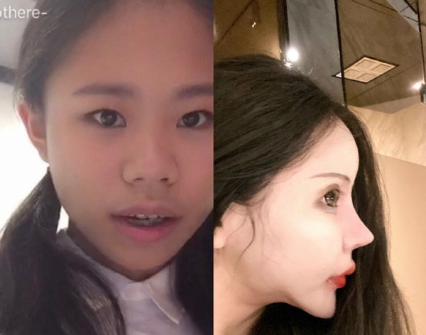 Hình ảnh cô gái 'dao kéo' quá đà gây hoang mang trên mạng xã hội