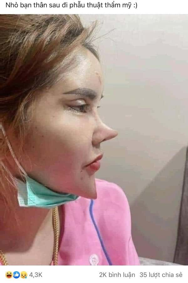 Hình ảnh cô gái 'dao kéo' quá đà gây hoang mang trên mạng xã hội